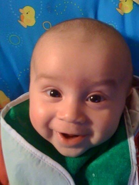 Anterior Facing Posterior